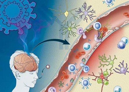 美研究揭「腦霧」秘密 新冠抗體攻擊傷腦血管